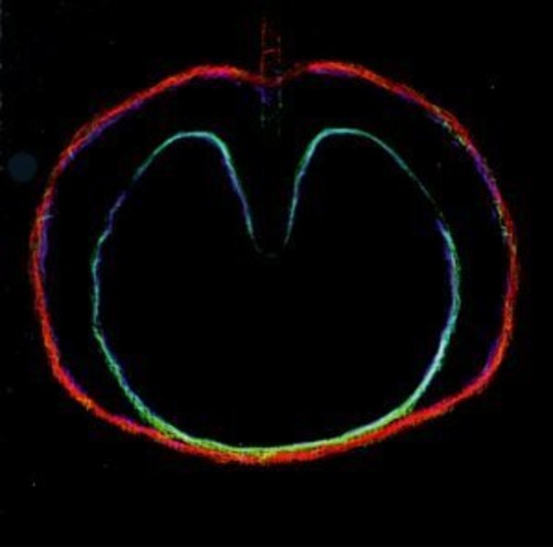 the album cover for Xtc - Wasp Star (Apple Venus Vol. II)