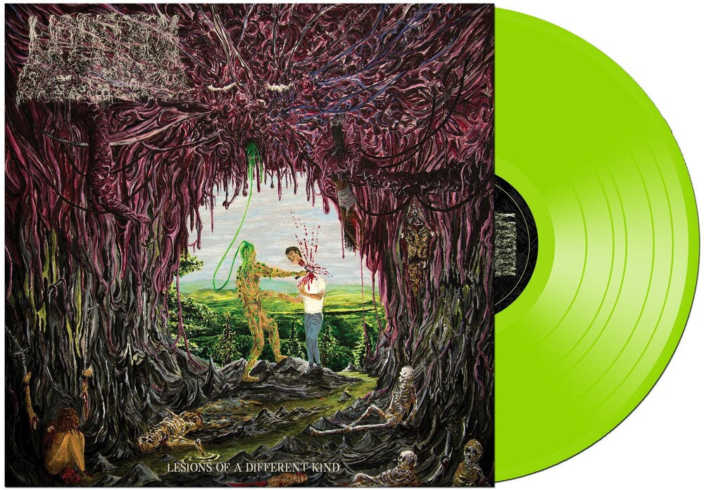 the album cover for Undeath - Lesions Of A Different Kind [Colored Vinyl] (Grn)